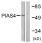 PIAS4 / PIASY Antibody (aa451-500)